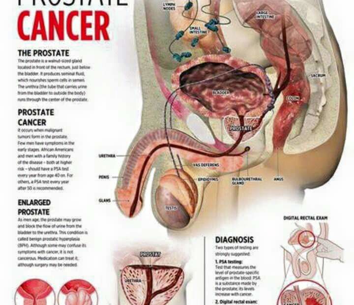 comment vider la prostate